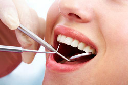 Teeth cleaning - Elmwood Park