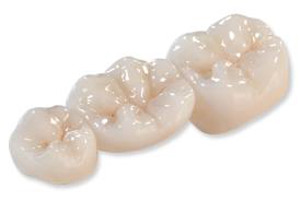 chicago zirconia crowns zirconia crowns chicago zirconia crowns